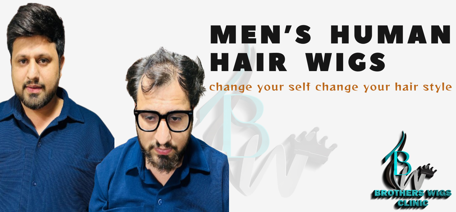 Hair Replacement Services