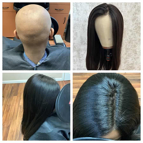 Hair Solutions for Cancer Patients Hair Solutions for Cancer Patients
